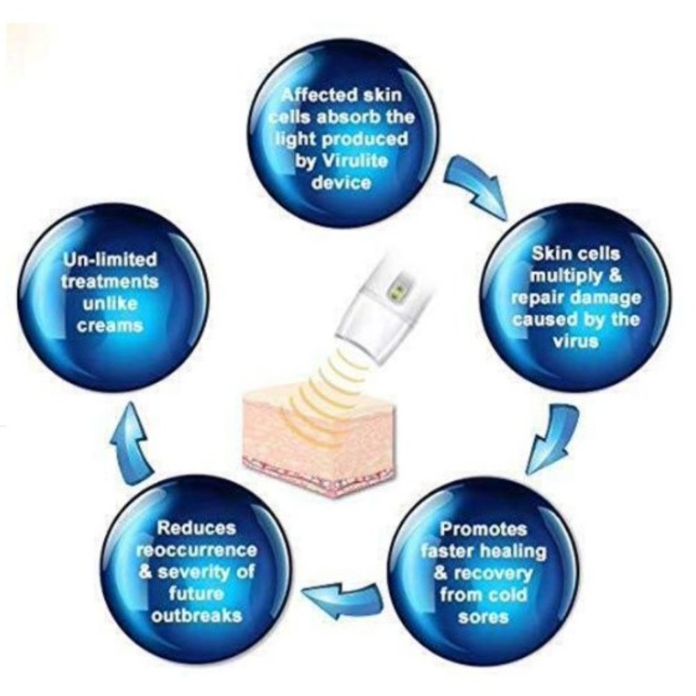 Virulite The Only FDA Approved Cold Sore Treatment Device - Picture 14 of 17